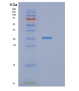 人GTF2B重组蛋白