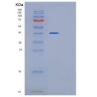 人GMPR2重组蛋白