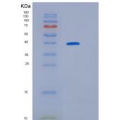 人GRB2相关衔接蛋白2(GRAP2)重组蛋白