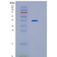 人GRB2相关衔接蛋白2(GRAP2)重组蛋白