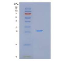人谷胱甘肽S转移酶ω1(GSTo1)重组蛋白