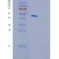 人糖原合酶激酶3β(GSK3b)重组蛋白