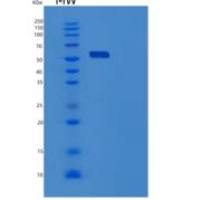 人Harmonin重组蛋白