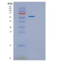 大鼠Gpt重组蛋白