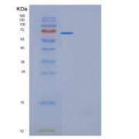 人葡萄糖6磷酸异构酶(GPI)重组蛋白