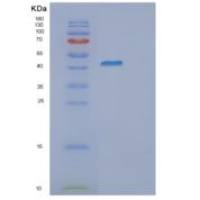 人G蛋白αZ(GNaZ)重组蛋白