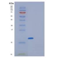 人GLRX5重组蛋白