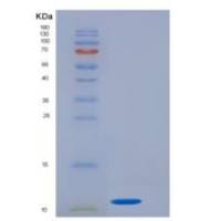 人通用转录因子ⅡH肽5(GTF2H5)重组蛋白