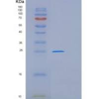 人谷胱甘肽S转移酶α1(GSTa1)重组蛋白