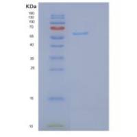 人磷脂酰肌醇蛋白聚糖3(GPC3)重组蛋白