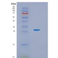 大鼠生长激素受体重组蛋白