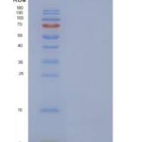 人血型糖蛋白C(GYPC)重组蛋白