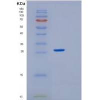 人生长因子受体结合蛋白2(Grb2)重组蛋白