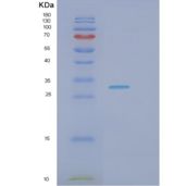 人肾损伤分子1(Kim1)重组蛋白