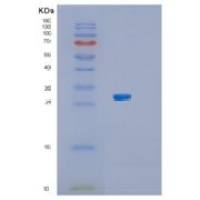 人生长激素受体重组蛋白