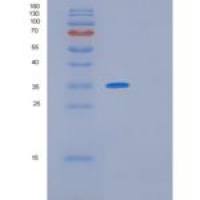 人GIMAP6重组蛋白