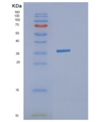 人甲型H1N1流感重组蛋白