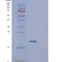 人GLIPR2重组蛋白
