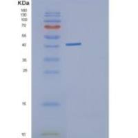 E.科利格尔达(E. coligldA)重组蛋白