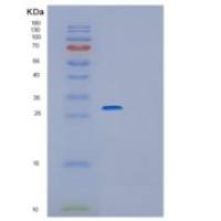 小鼠谷胱甘肽S转移酶μ1(GSTM1)重组蛋白