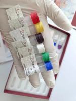 人抗α-胞衬蛋白抗体IgG/IgA(α-Fodrin IgG/IgA)ELISA试剂盒