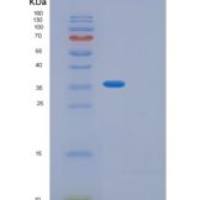 人GIPC2重组蛋白