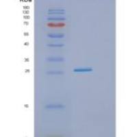 人GTF3C6重组蛋白