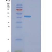 人GOLM1重组蛋白