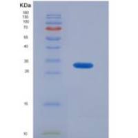 人磷脂酰肌醇蛋白聚糖4(GPC4)重组蛋白