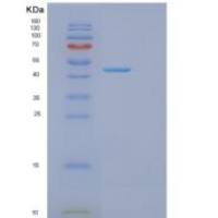 小鼠Got1重组蛋白
