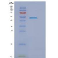 GOR大肠杆菌重组蛋白