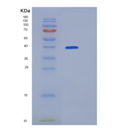 人GRB2相关衔接蛋白2(GRAP2)重组蛋白