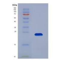 人Gremlin 1蛋白(GREM1)重组蛋白