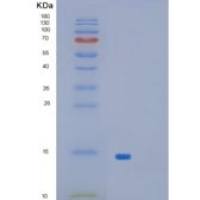 大肠杆菌glpE重组蛋白