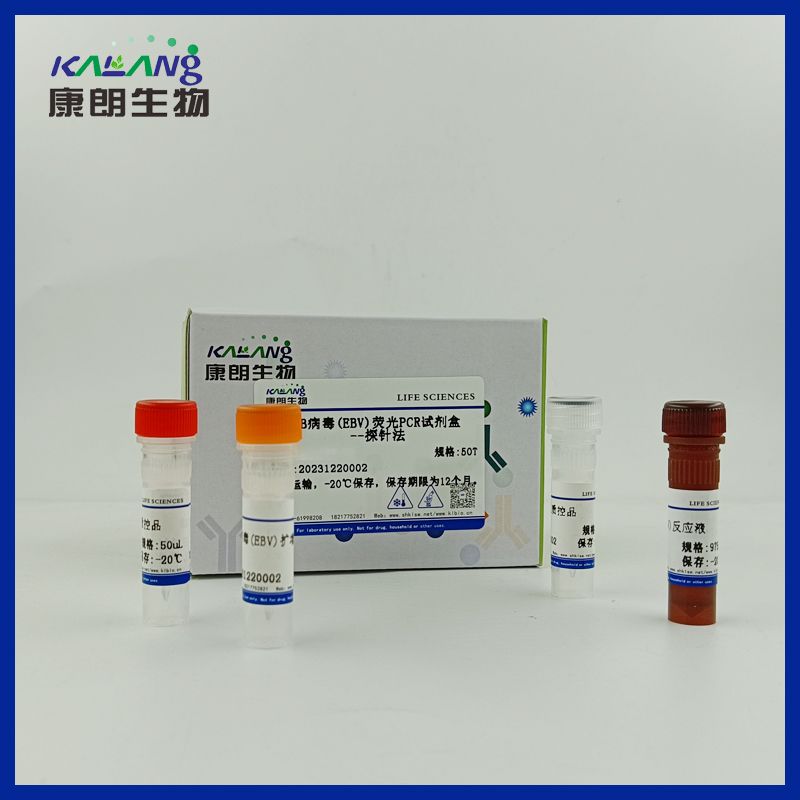 EB病毒(EBV)荧光PCR试剂盒-探针法 
