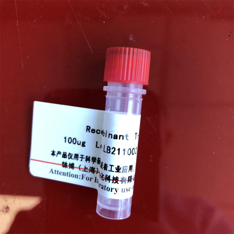 HRP-小鼠抗乙肝表面抗原
