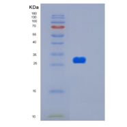 人HTATIP2重组蛋白
