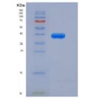 人胰岛素样生长因子1(IGF1)重组蛋白