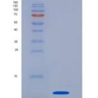 人白介素8(IL8)重组蛋白