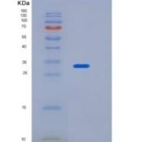 人关卡蛋白HUS 1（HUS 1）重组蛋白