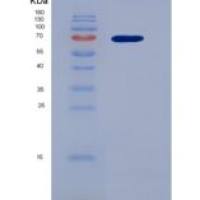 人肝细胞生长因子(HGF)重组蛋白