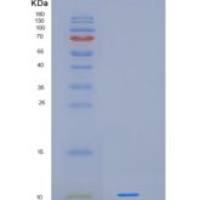 人早期应答基因3(IER3)重组蛋白