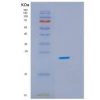 大肠杆菌idnk重组蛋白