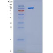人己糖激酶1（Hexokinase 1）重组蛋白