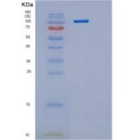 人己糖激酶1（Hexokinase 1）重组蛋白