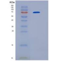 人HSP70B重组蛋白