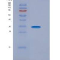 人真核白细胞介素29(IL29)重组蛋白