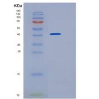 人HOMER2重组蛋白