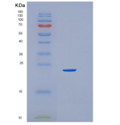 人HEBP1重组蛋白