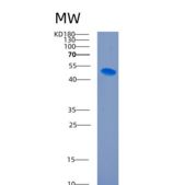 人细胞间粘附分子1(ICAM1)重组蛋白